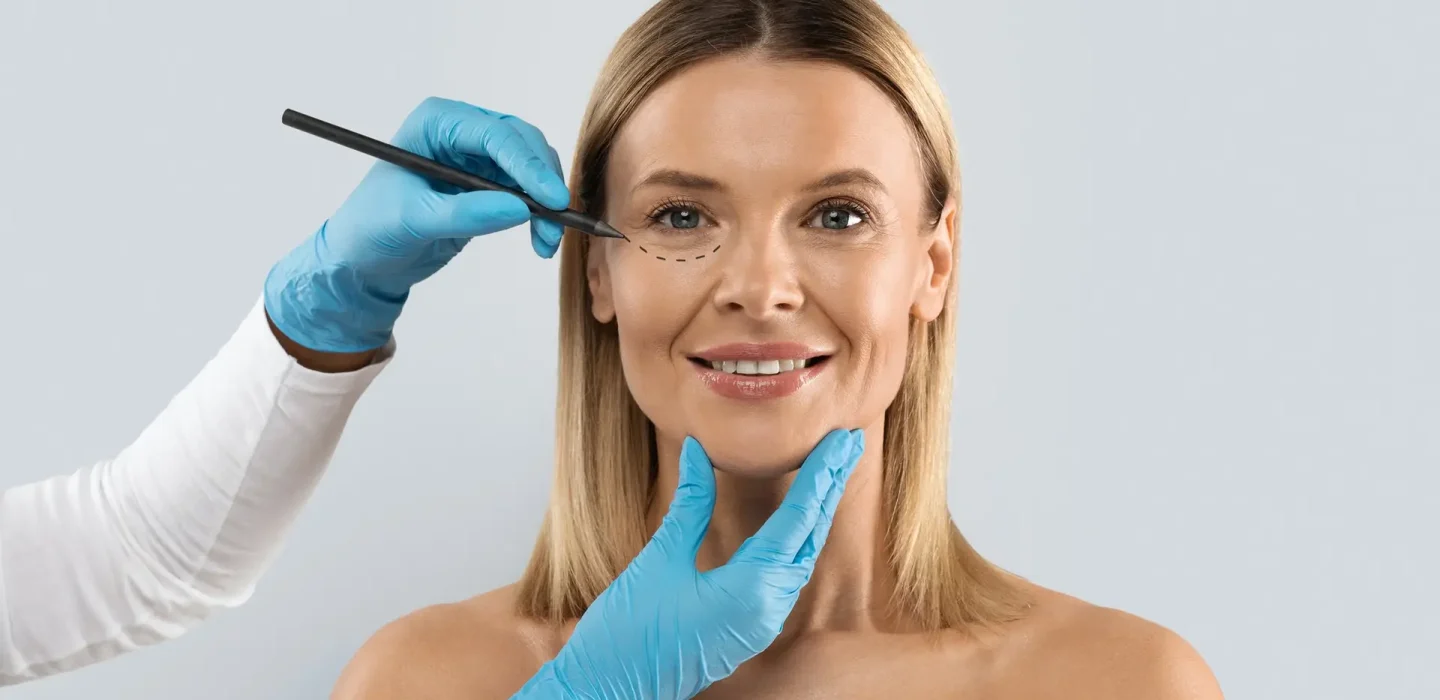 Clinician marks dotted under-eye area for cosmetic surgery on a smiling patient wearing no makeup.